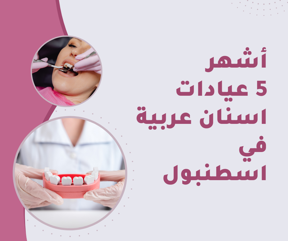 Read more about the article أشهر 5 عيادات اسنان عربية في اسطنبول